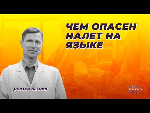 Видео: Чем опасен налет на языке.