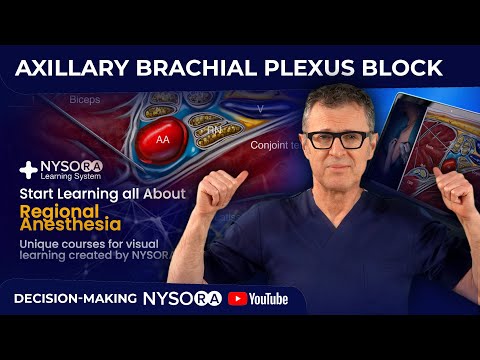 Видео: Блокада подмышечного сплетения: принятие решений – экспресс-курс с доктором Хаджичем