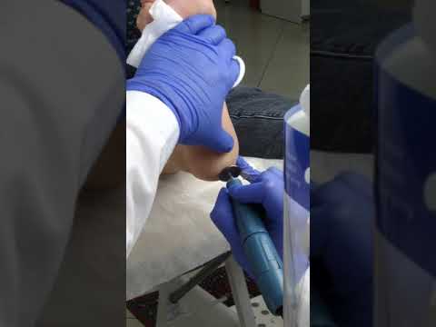 Видео: Секретный урок: коллаген-педикюр 1 диском и 3-мя файлами