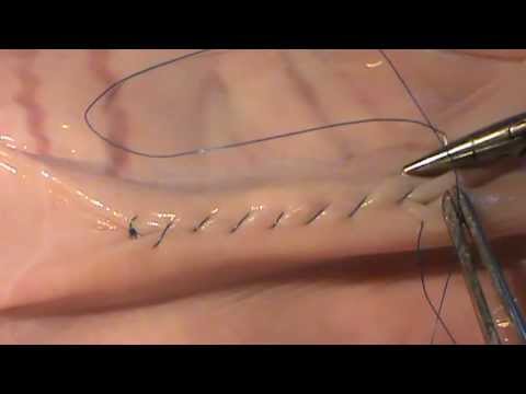 Видео: Кишечный шов Ламбера. Docent A.D. Stepanov, ПДАТУ