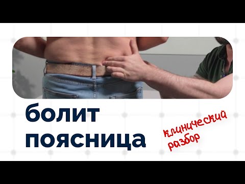 Видео: "Когда сижу - болит поясница" | Клинический разбор