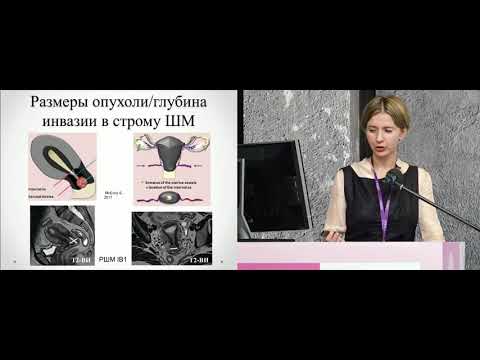 Видео: «Подводные камни» МР-диагностики рака шейки матки: что нужно знать клиницисту