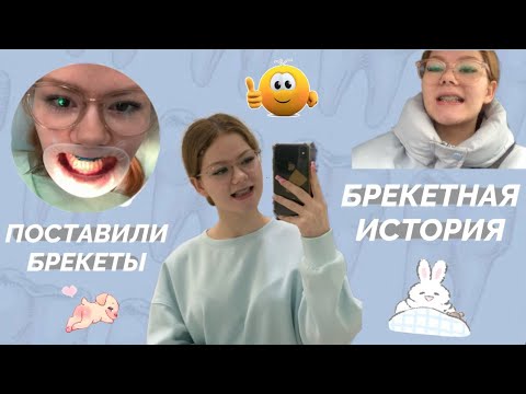 Видео: МНЕ ПОСТАВИЛИ БРЕКЕТЫ🦷