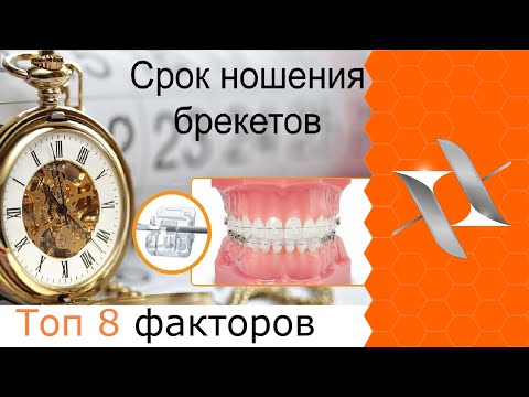 Видео: Топ 8 факторов, определяющих сроки ношения брекетов. Время ортодонтического лечения