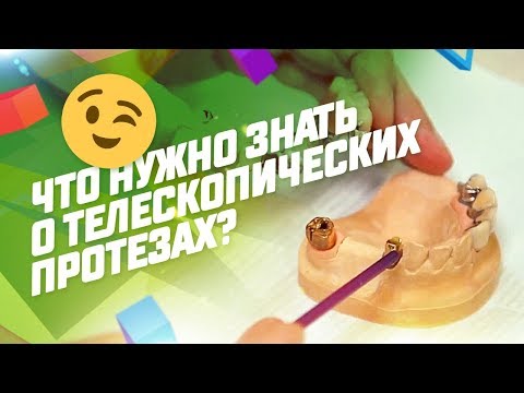 Видео: Что нужно знать о телескопических протезах?