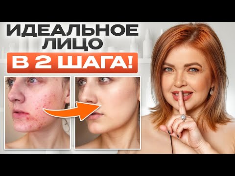 Видео: Акне уйдет НАВСЕГДА, если сделать ЭТО! Как избавиться от любых высыпаний?
