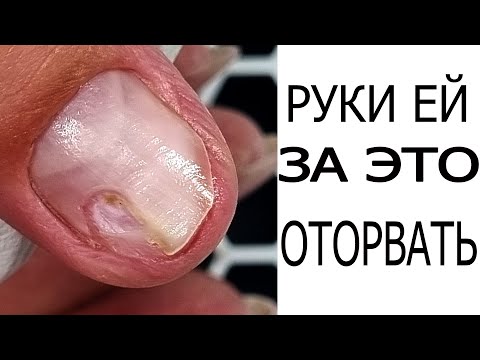 Видео: динамика ТРАВМЫ
