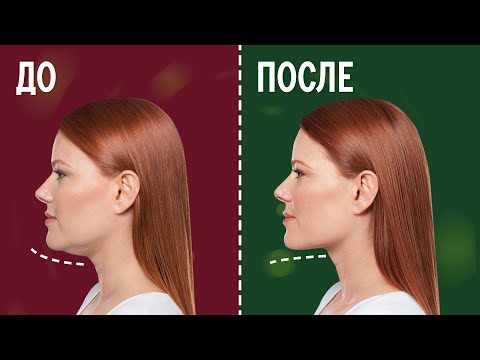 Видео: Как убрать второй подбородок! Почему косметолог не помогает?