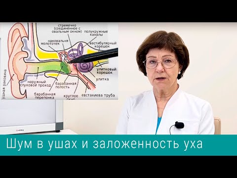 Видео: Шум в ушах и заложенность уха