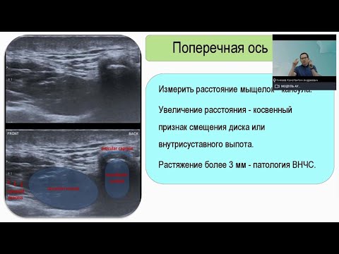 Видео: Височно-челюстной сустав. Возможности ультразвукового исследования