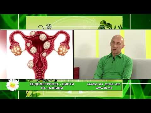 Видео: Фактор здравје - Ендометриоза - цисти на јајници