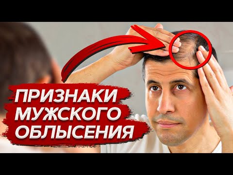 Видео: Почему у МУЖЧИН выпадают ВОЛОСЫ? / Учимся самостоятельно определять первые признаки облысения