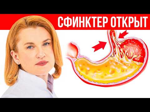 Видео: Что такое ИЗЖОГА, почему она ПОЯВЛЯЕТСЯ и как её ЛЕЧИТЬ?