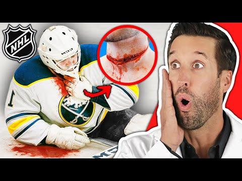 Видео: Doctor ER смотрит на самые болезненные спортивные травмы | Сборник