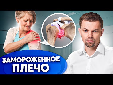 Видео: Опасная БОЛЬ в ПЛЕЧЕ! Правильное лечение адгезивного капсулита