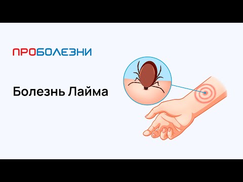 Видео: Болезнь Лайма