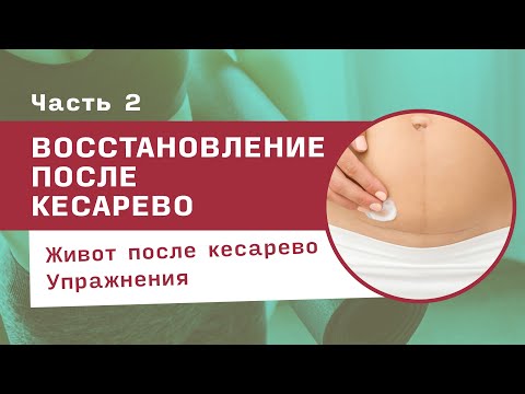 Видео: Как убрать живот и быстро восстановиться после кесарева? Три упражнения после КС — пошагово