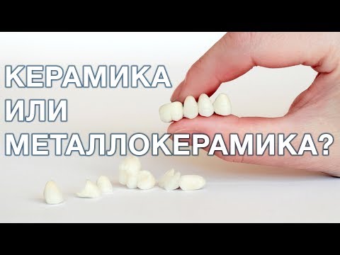 Видео: Керамика или металлокерамика, что лучше выбрать?