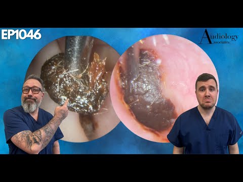 Видео: То, что скрывается в ухе этого подростка, взорвёт вам мозг! - EP1046