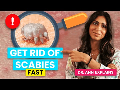Видео: Лечение чесотки: как применять перметрин и предотвратить повторное заражение (лучшие советы врача)