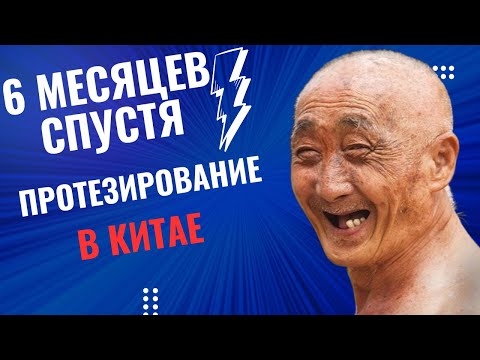 Видео: ВСЯ ПРАВДА О ПРОТЕЗИРОВАНИИ В КИТАЕ, ХЭЙХЭ 2024 ! 6 МЕСЯЦЕВ СПУСТЯ...