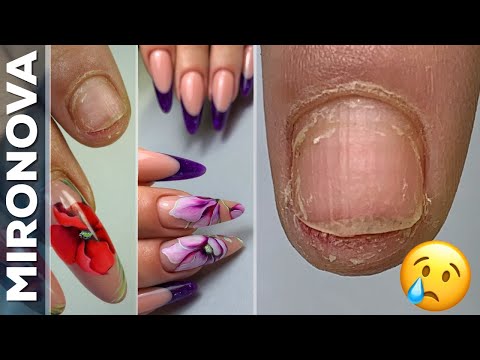 Видео: Коррекция наращённых ногтей/Выкладной френч / Рисую магнолии гель-лаком