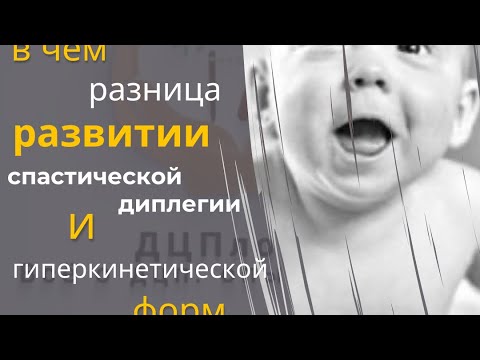 Видео: В чем разница развитии спастической диплегии и гиперкинетической форм