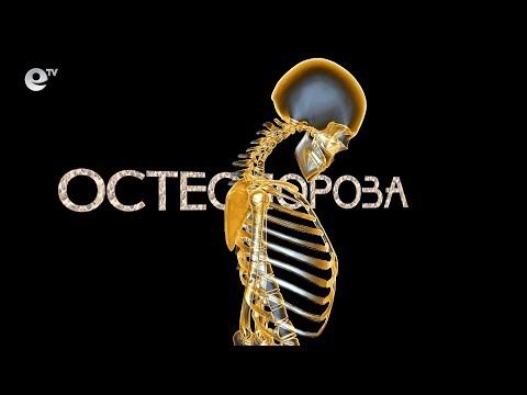 Видео: Здраве - Остеопорозата - тихият убиец