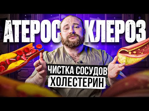 Видео: ВСЁ ОБ АТЕРОСКЛЕРОЗЕ. Причины и лечение холестериновых бляшек. Чистка сосудов. Доктор Королёв