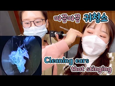 Видео: Очистка моих ушей, что жуткий/Cleaning my ears that stinging