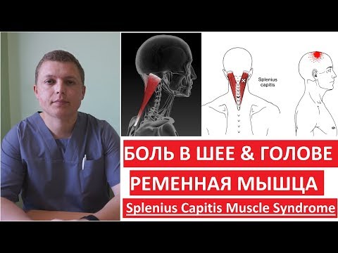 Видео: Ременная мышца | Как лечить боль в шее и голове | Splenius Capitis Muscle Syndrome