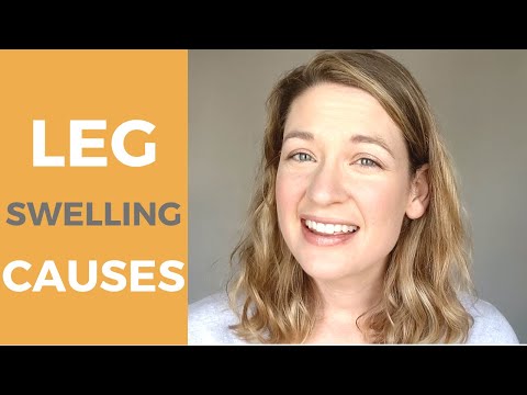 Видео: Причины отёка нижних конечностей | Практический пример для начинающих медсестёр