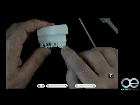 Видео: Советы по фиксации брекетов от Тома  Питтса