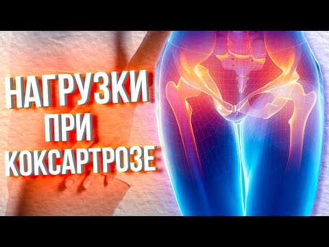 Видео: Нагрузки При КОКСАРТРОЗЕ - ЧТО НУЖНО ЗНАТЬ | Тренер Хапаев