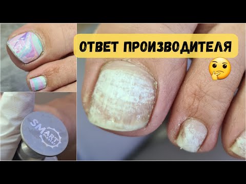 Видео: Что с ногтями после пленок? Пришлось отказать! Аппаратный педикюр.