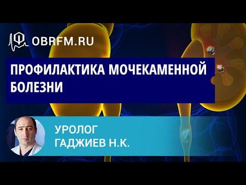 Видео: Уролог Гаджиев Н.К.: Профилактика мочекаменной болезни