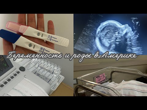 Видео: БЕРЕМЕННОСТЬ И РОДЫ В США🤰🏻👶🏻Преэклампсия/Кесарево/Ранние роды/Мой опыт
