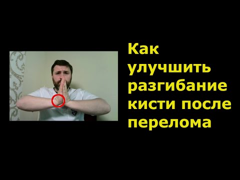 Видео: Как улучшить разгибание кисти после перелома