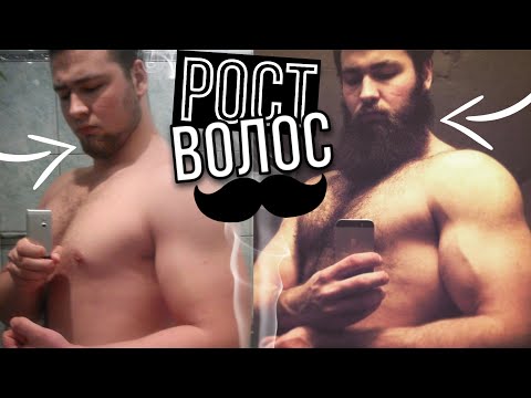 Видео: Не растет Борода или выпадают Волосы? Миноксидил и другие