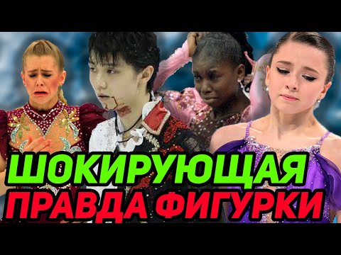 Видео: Кровь Юдзуру Ханю, Отравление, Домогательства, Нападение. ТОП Громких Скандалов в Фигурном Катании.