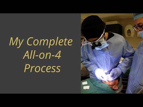 Видео: Все на 4 — чего ожидать