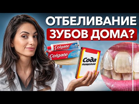 Видео: Народные методы отбеливания – ПОМОГАЮТ или КАЛЕЧАТ?! / Секреты белоснежной улыбки без виниров