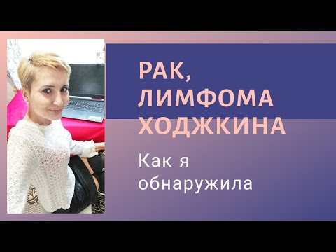 Видео: Рак, Лимфома Ходжкина - как я узнала. Симптомы лимфомы. Лимфома 4 стадии