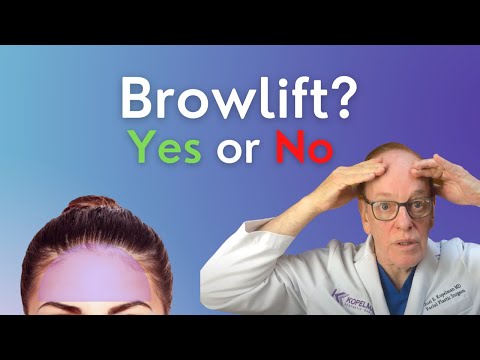 Видео: Преимущества подтяжки бровей | Пластический хирург объясняет подтяжку бровей