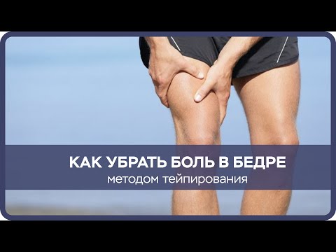 Видео: Тейпирование бедра  Боль в бедре  Четырехглавая мышца бедра