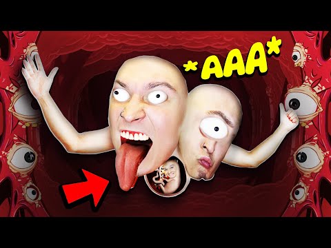 Видео: Я стал *ОЧЕНЬ МИЛЫМ* Уродом! (Struggling)