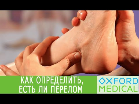 Видео: Как определить, есть ли ПЕРЕЛОМ