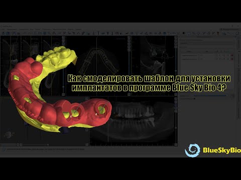 Видео: Моделирование шаблона для имплантации в Blue Sky Bio под навигационный набор Osstem | Юркевич Роман