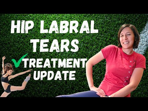 Видео: Разрывы вертлужной губы | Всё, что нужно знать + Исследования