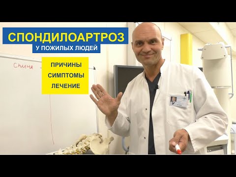 Видео: СПОНДИЛОАРТРОЗ У ПОЖИЛЫХ ЛЮДЕЙ: причины, симптомы и лечение